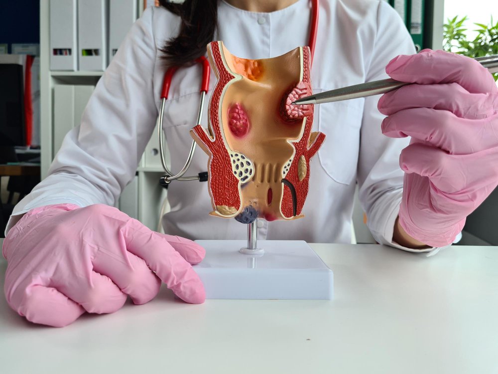Healthcare professionals performing laparoscopy in operating room